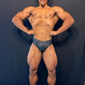 Anderson Fernandes dos Santos - NTB
